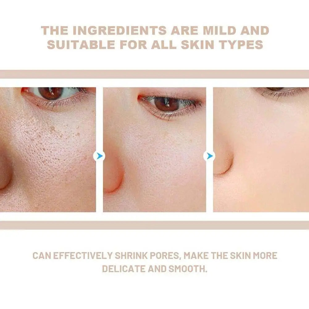 Dr. Melaxin Rice Exfoliating Serum Facial Moisturizing Soften Serum Blackhead Removal Hydrating Pore Shrinking Korean Skin Care