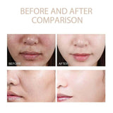 Dr. Melaxin Rice Exfoliating Serum Facial Moisturizing Soften Serum Blackhead Removal Hydrating Pore Shrinking Korean Skin Care